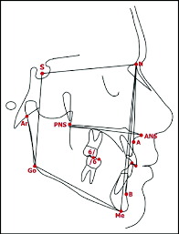 Pay contactlessly with your snb visa® debit and credit cards via your smart phone. Cephalometric Points Lines And Angles Used In Analysis Sna Snb Download Scientific Diagram
