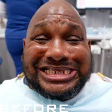 The countdown to the 2024 Bonito Blast is here! Make sure you don't miss  your chance to be part of the excitement. Take a break