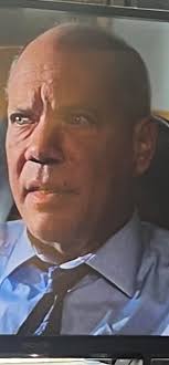 Boy he lost a lot of hair!