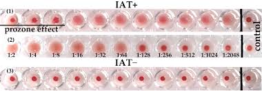 Image result for Indirect Coombs