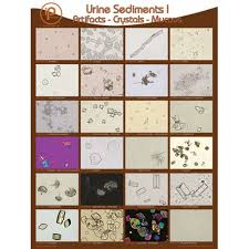 Urine Sediments Posters And Binder Cards Marketlab Inc Urinal Sediment Medical Laboratory Scientist
