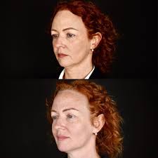 Another one of our lovely patients has...