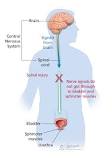 Image result for icd 9 code for neurogenic bladder