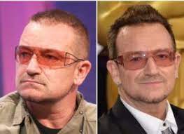 Although she would've been long used to the stress associated with being in the spotlight, it was a specific incident that triggered hair loss in her case. Celebrities With Hair Transplants Skalptec Uk And Europe