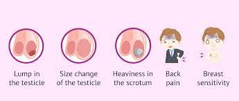 Testicular cancer symptoms can be similar to other conditions that affect the testicles, such as infections. Testicular Cancer Symptoms
