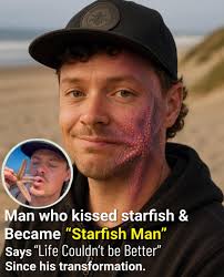 I should have listened when they said, “don't kiss the sea animals”.. It  finally happened.. 😩 #animals #nature