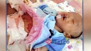 Jangkitan yang lebih serius adalah jangkitan pada buah pinggang yang juga dikenali sebagai pyelonephritis. 25 Julai 2018 Derita Bayi Alif Nafis Media Prima Humanitarian Fund Tabung Media Prima