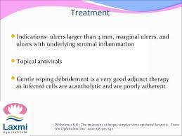Herpes Simplex Keratitis Herpes Zoster Opthalmicus