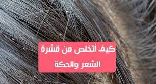 كيف أتخلص من قشرة الشعر والحكة قشرة الشعر هي حالة منتشرة جدا بين النساء والرجال ايضا وذلك بسبب التقشير المفرط لفروة الرأس وهذا يسبب Convenience Store Products
