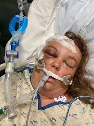 Place down at the lake