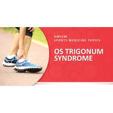 Os Trigonum Syndrome Sports Medicine Today