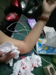 Tafsir mimpi melihat tangan berdarah. 21 Gambar Tangan Berdarah Richi Wallpaper