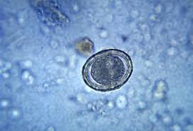 Pinworm is the most common of all the parasitic roundworm infections. Roundworm Nematode Species Ascaris Lumbricoides Britannica