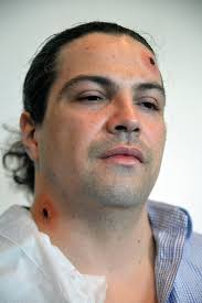 La naturaleza muerta o La espectacularización de la violencia — Abel Azcona