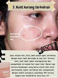 Bahaya Menggunakan Sunscreen saat Malam Hari