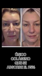 Somos el único colágeno que se absorbe en su totalidad el 100% !!! Dis...