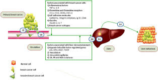 Symptoms of breast cancer metastasis to liver metastatic breast cancer may grow silently in the body while you are completely unaware. A Model For Breast Cancer Liver Metastasis I Intravasation Invasive Download Scientific Diagram