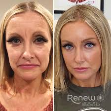 Renewaestheticsandivhydrationbar