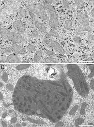 Check spelling or type a new query. Three Dimensional Ultrastructure Of Giant Mitochondria In Human Non Alcoholic Fatty Liver Disease Scientific Reports