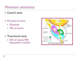 Of course, your specialist is the main person whose advice you should follow but it doesn't do anyone harm. Prostate Cancer à¸™à¸ž à¸Š à¸Šà¸Š à¸¢ à¸«à¸­à¸¡à¹€à¸à¸• Ppt Download