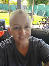 Breast Cancer and Hair Loss After Chemotherapy