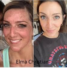 This beautiful lady is a friend of my Y sister Jamie. ⬇️⬇️ Read her Daily  You Liquid Collagen journey This makes my heart sooo happy as I've had  several cancer survivors inquire