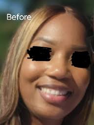 Dr. Lakin did such a fantastic job