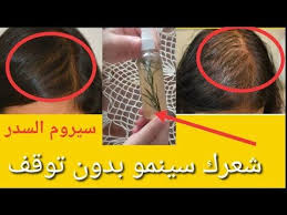بدون زيت رشة واحدة يوميا بدون غسل شعرك سينمو بدون توقف youtube
