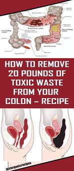 Pin By Edna Hahn On Healthy Tips 20 Pounds How To Remove Colon Cleanse Diet