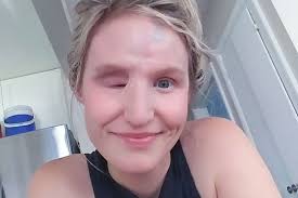 Fundraiser for Christine West by Melissa Drew : A New Eye For Christine