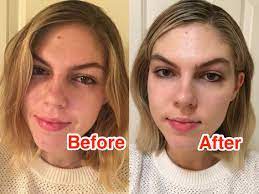 Herbal supplements have unknown or poorly researched drug interactions and side effects. Review Vitamin C Serum