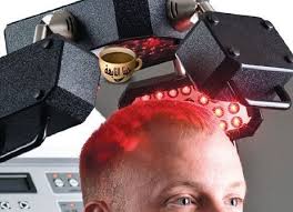 زراعة الشعر في السعودية تعرف على أفضل أسعار ومراكز وتكلفة Hair Transplant Saudia نظرا لاحتواء السعودية على عدد كبير Hair Transplant Cost Hair Transplant Hair