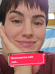 El Accidente de la QUEM🧚‍♀️HADA al Broncearse