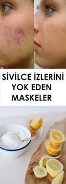 Sivilce Izlerini Yok Eden Maskeler Www Vipbakim Com Sivilce Izi Cilt Bakimi Maskeler