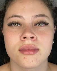 Tatiane Longen (@esteticistatatianelongen) • Instagram photos and videos