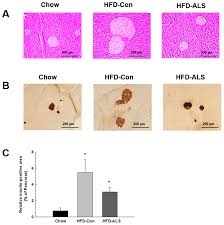 The following converter can be used to convert between calories and other common food energy units. Ijms Free Full Text Lemon Balm Extract Als L1023 Regulates Obesity And Improves Insulin Sensitivity Via Activation Of Hepatic Ppara In High Fat Diet Fed Obese C57bl 6j Mice Html