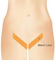 Laser hair removal on chin before and after via reese family practice. Laser Hair Removal Seattle