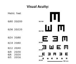 A Lady With Right Eye Total Blindness And Actifit Report