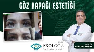 Goz Kapagi Estetigi Izmir Ekol Hastanesi Youtube