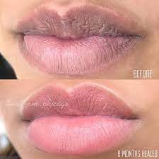 Imagine Never Needing A Lipstick Tag Someone Who Needs This Lip Hyperpigmentation Is A Common Skin Issue Wh Lip Hyperpigmentation Permanent Makeup Dark Lips