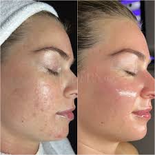 Jade Scalp & Body Comb — The Modern Ū