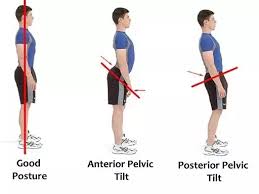 Check spelling or type a new query. What Yoga Poses Will Fix An Anterior Pelvic Tilt Quora