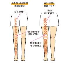 もはや国民病 イラストで知る 変形性膝関節症 基礎知識 毎日が発見ネット 変形 筋力トレーニング 知識