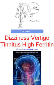 Vertigo Remedies Ginger How To Cure Vertigo Vertigo Treatment Vertigo