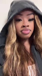 I’m so pretty for a girl with no teeth #TempoParou #TrendMomentos  #greenscreenvideo #fyp #glowup #cranialdysplasia