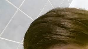Was Ist Das Weisse An Den Haarspitzen Haare Korper Beauty