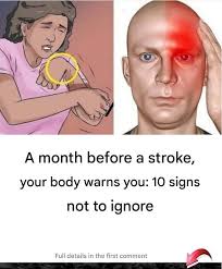 Stroke: These warning signs that appear 1 month before !!! details in  comments