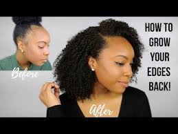 Learn How To Grow Back Edges With Castor Oil With These Helpful Tips And Tricks To Regrow Your Natural Hair Wi Thin Natural Hair Natural Hair Styles Edges Hair