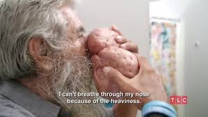 Roger has struggled with the...