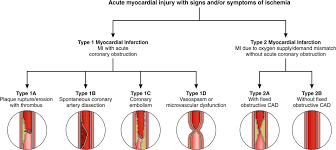 A Proposal For Modest Revision Of The Definition Of Type 1 And Type 2 Myocardial Infarction Circulation